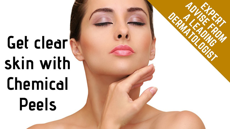 Chemical peels from a dermatologist